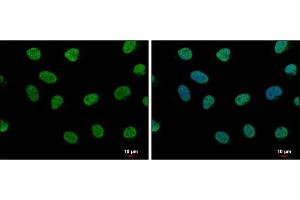 ICC/IF Image LDB1 antibody [N2C3] detects LDB1 protein at nucleus by immunofluorescent analysis.