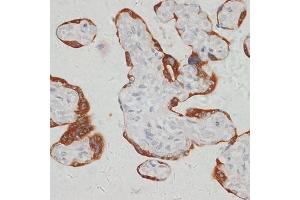 Immunohistochemistry of paraffin-embedded human placenta using S antibody (ABIN6132970, ABIN6147387, ABIN6147388 and ABIN6215904) at dilution of 1:100 (40x lens).