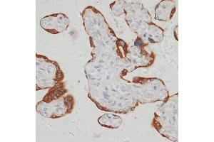 Immunohistochemistry of paraffin-embedded human placenta using S antibody (ABIN6132970, ABIN6147387, ABIN6147388 and ABIN6215904) at dilution of 1:100 (40x lens). (SARS2 anticorps  (AA 289-518))