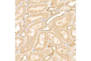 Immunohistochemistry of paraffin-embedded rat kidney using PFKP antibody (ABIN7269309) at dilution of 1:100 (40x lens). (PFKP anticorps)