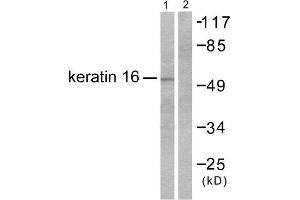 Western Blotting (WB) image for anti-Keratin 16 (KRT16) (C-Term) antibody (ABIN1848628) (KRT16 anticorps  (C-Term))