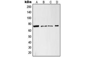 Western blot analysis of c-RAF expression in A431 (A), HeLa (B), RAW264. (RAF1 anticorps  (Center))