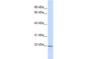 WB Suggested Anti-ZFAND5 Antibody Titration:  0. (ZFAND5 anticorps  (Middle Region))