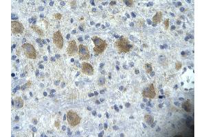 Rabbit Anti-TAF15 Antibody       Paraffin Embedded Tissue:  Human neural cell   Cellular Data:  Epithelial cells of renal tubule  Antibody Concentration:   4. (TAF15 anticorps  (N-Term))