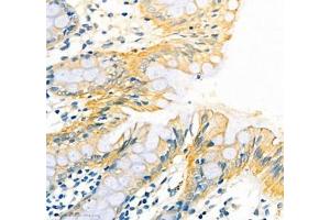 Immunohistochemistry of paraffin embedded human colon using ATP1HC1 (ABIN7073160) at dilution of 1:500 (400x lens)