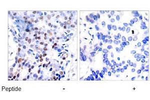 Image no. 2 for anti-Jun Proto-Oncogene (JUN) (AA 89-93) antibody (ABIN197128) (C-JUN anticorps  (AA 89-93))