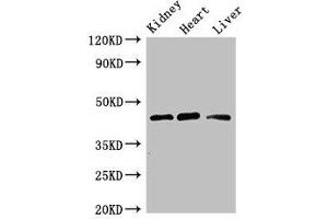 Western Blot Positive WB detected in: Mouse kidney tissue, Rat heart tissue, Rat liver tissue All lanes: WTAP antibody at 3 μg/mL Secondary Goat polyclonal to rabbit IgG at 1/50000 dilution Predicted band size: 45, 18 kDa Observed band size: 45 kDa (WTAP anticorps  (AA 1-151))