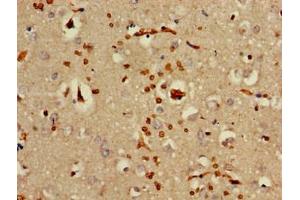 Immunohistochemistry of paraffin-embedded human brain tissue using ABIN7142174 at dilution of 1:100 (OAS3 anticorps  (AA 424-565))