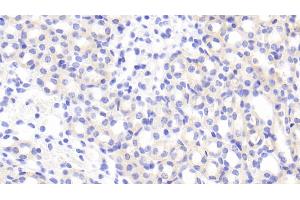 Detection of ADAMTS2 in Mouse Kidney Tissue using Polyclonal Antibody to A Disintegrin And Metalloproteinase With Thrombospondin 2 (ADAMTS2)