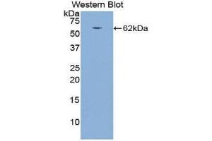Western Blotting (WB) image for anti-Cathepsin A (CTSA) (AA 234-494) antibody (ABIN1858538) (CTSA anticorps  (AA 234-494))