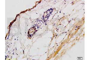Formalin-fixed and paraffin embedded rat skin tissue labeled with Anti-CK2 Polyclonal Antibody,Unconjugated (ABIN730813) at 1:200 followed by conjugation to the secondary antibody and DAB staining (Keratin 2 anticorps  (AA 535-638))