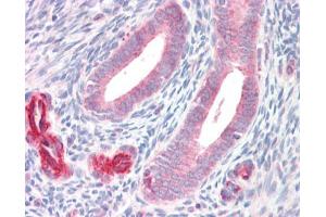 IHC-P Image ADAM33 antibody [C2C3], C-term detects ADAM33 protein at cytoplasm on human placenta by immunohistochemical analysis.