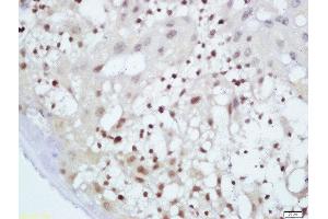 Formalin-fixed and paraffin embedded mouse placenta labeled with Anti-GnRHR Polyclonal Antibody, Unconjugated  at 1:200 followed by conjugation to the secondary antibody and DAB staining (MAF anticorps  (AA 341-403))