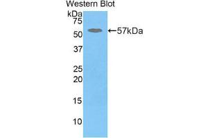 Western Blotting (WB) image for anti-Glucosidase, Beta, Acid (GBA) (AA 248-508) antibody (ABIN3205107) (GBA anticorps  (AA 248-508))
