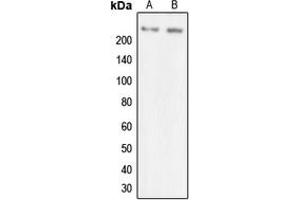 Western blot analysis of MYO7A expression in SKOVCAR (A), HEK293T (B) whole cell lysates.