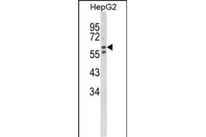 Western blot analysis of HEXA Antibody (Center) (ABIN652263 and ABIN2841133) in HepG2 cell line lysates (35 μg/lane). (Hexosaminidase A anticorps  (AA 315-343))