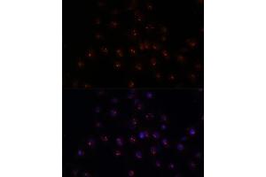 Immunofluorescence analysis of C6 cells using METTL16 antibody (ABIN7268501) at dilution of 1:100. (METTL16 anticorps  (AA 263-562))