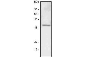 A549 (lung carcinoma) cell lysate was resolved by SDS-PAGE, transferred to PVDF membrane and probed with anti-human LYVE-1 antibody (1:500). (LYVE1 anticorps  (AA 25-235))