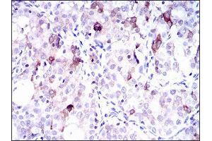 Immunohistochemistry (IHC) image for anti-Solute Carrier Family 27 (Fatty Acid Transporter), Member 5 (SLC27A5) (AA 508-570) antibody (ABIN1845743) (SLC27A5 anticorps  (AA 508-570))