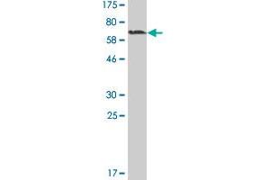 Western Blot detection against Immunogen (60. (MAGEA11 anticorps  (AA 1-319))