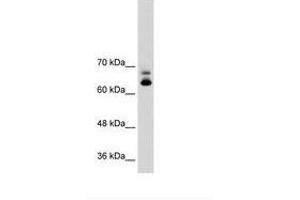 Image no. 2 for anti-Metastasis Associated 1 Family, Member 2 (MTA2) (C-Term) antibody (ABIN203470) (MTA2 anticorps  (C-Term))