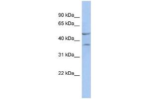 WB Suggested Anti-NKX6-1 Antibody Titration:  0. (NKX6-1 anticorps  (N-Term))