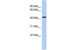 WB Suggested Anti-DFFB Antibody Titration: 0. (DFFB anticorps  (Middle Region))