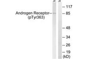 Western blot analysis of extracts from Jurkat cells treated with UV 15', using Androgen Receptor (Phospho-Tyr363) Antibody. (Androgen Receptor anticorps  (pTyr363))