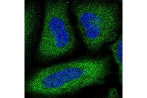 Immunofluorescent staining of HeLa cells with PDE3A polyclonal antibody  (Green) shows localization to cytosol.