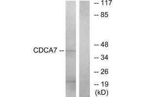 Western Blotting (WB) image for anti-Cell Division Cycle Associated 7 (CDCA7) (Internal Region) antibody (ABIN1850260) (CDCA7 anticorps  (Internal Region))