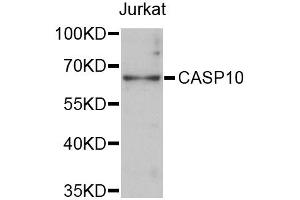 Western blot analysis of extracts of Jurkat cells, using CASP10 antibody (ABIN5997362) at 1:3000 dilution. (Caspase 10 anticorps)