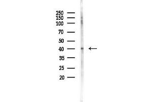 anti-GATA Binding Protein 1 (Globin Transcription Factor 1) (GATA1) (pSer142) antibody