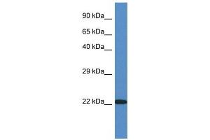 Western Blot showing RPL14 antibody used at a concentration of 1 ug/ml against Fetal Kidney Lysate (RPL14 anticorps  (C-Term))