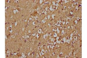 IHC image of ABIN7139867 diluted at 1:100 and staining in paraffin-embedded human brain tissue performed on a Leica BondTM system.