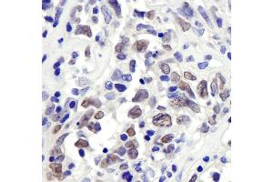 Immunohistochemistry (IHC) image for anti-Retinoblastoma Binding Protein 7 (RBBP7) (AA 1-50) antibody (ABIN7454701)