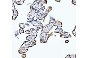 IHC analysis of PDE4DIP using anti-PDE4DIP antibody (ABIN7602691).