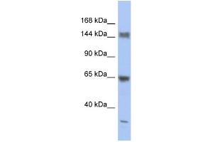 WB Suggested Anti-ATXN2 Antibody Titration:  0. (Ataxin 2 anticorps  (Middle Region))