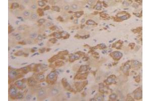IHC-P analysis of Human Liver Tissue, with DAB staining. (INHBC anticorps  (AA 236-352))