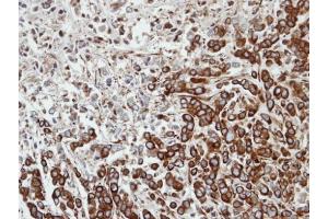 IHC-P Image Immunohistochemical analysis of paraffin-embedded MDA-MB-468 xenograft, using FPGT, antibody at 1:100 dilution. (FPGT anticorps)