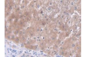 DAB staining on IHC-P; Samples: Human Liver Tissue