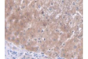 DAB staining on IHC-P; Samples: Human Liver Tissue (TREX1 anticorps  (AA 6-369))