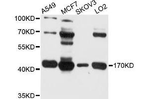 Western blot analysis of extract of various cells, using BDH1 antibody. (BDH1 anticorps)