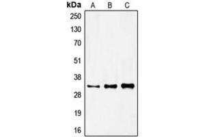 Western blot analysis of FOXR1 expression in HeLa (A), mouse kidney (B), rat kidney (C) whole cell lysates.