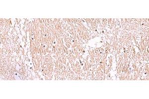 Immunohistochemistry of paraffin-embedded Human brain tissue using RIC8A Polyclonal Antibody at dilution of 1:55(x200) (RIC8A anticorps)