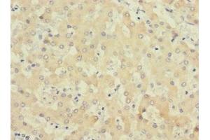 Immunohistochemistry of paraffin-embedded human liver tissue using ABIN7174246 at dilution of 1:100 (COQ4 anticorps  (AA 31-265))