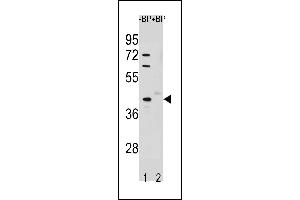 Western blot analysis of STK25 Antibody (C-term) Pab (ABIN1881851 and ABIN2843256) pre-incubated without(lane 1) and with(lane 2) blocking peptide in A549 cell line lysate. (STK25 anticorps  (C-Term))