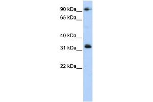 WB Suggested Anti-CCDC69 Antibody Titration: 0. (CCDC69 anticorps  (Middle Region))