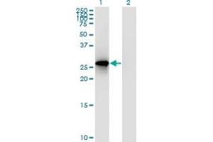 Western Blot analysis of RPP30 expression in transfected 293T cell line by RPP30 polyclonal antibody (A01).