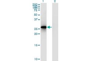 Western Blot analysis of RPP30 expression in transfected 293T cell line by RPP30 polyclonal antibody (A01).