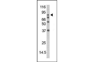 Image no. 1 for anti-Death-Domain Associated Protein (DAXX) (pSer213) antibody (ABIN358116) (DAXX anticorps  (pSer213))